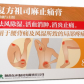 复方祖司麻止痛膏